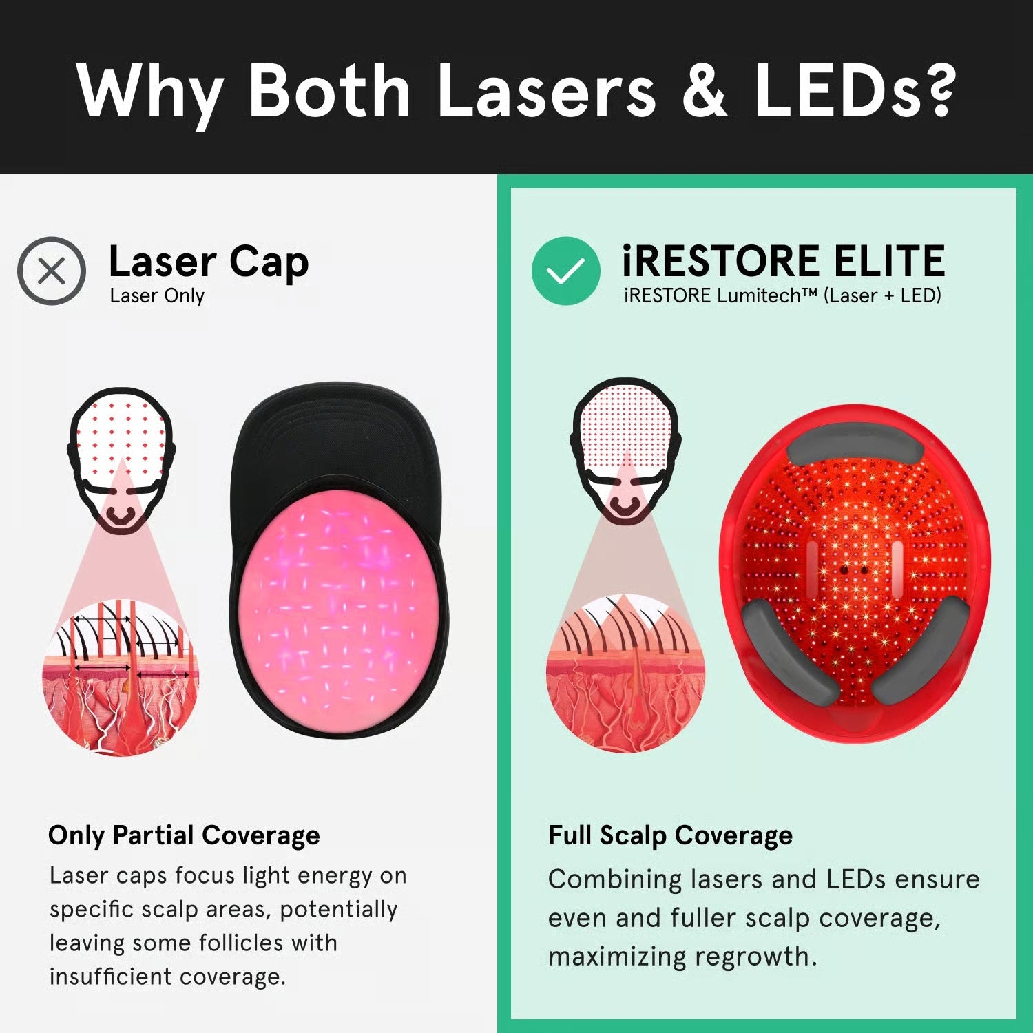 iRESTORE Elite